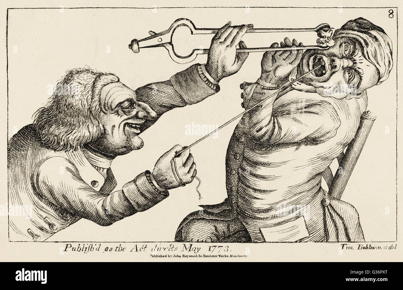 Drawing a tooth with the help of a hot coal and a length of string,    as depicted by Tim Bobbin (the pseudonym of John Collier, an English caricaturist and satirical poet based in Lancashire).      Date: 1773 Stock Photo