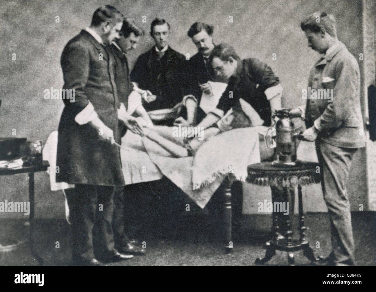Operation with Lister's antiseptic spray in use        Date: late 19th century Stock Photo