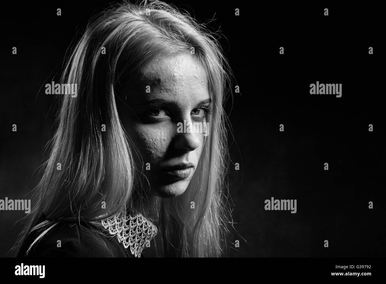 blond girl with pimply skin crying on black background, monochrome Stock Photo