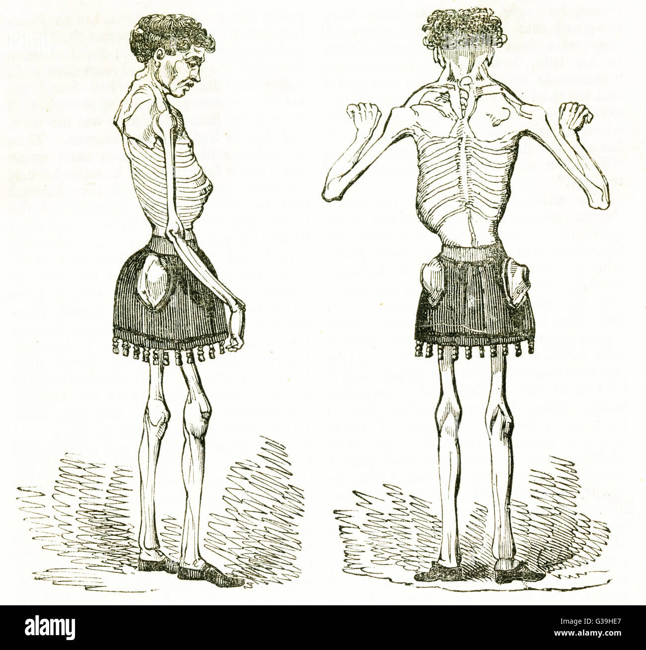 CLAUDE AMBROISE SEURAT  skeletal Frenchman        Date: flourished 1820s Stock Photo