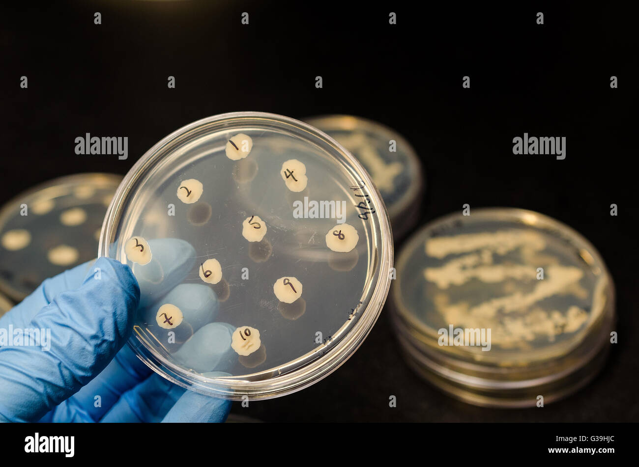 Bacterial culture plates Stock Photo Alamy