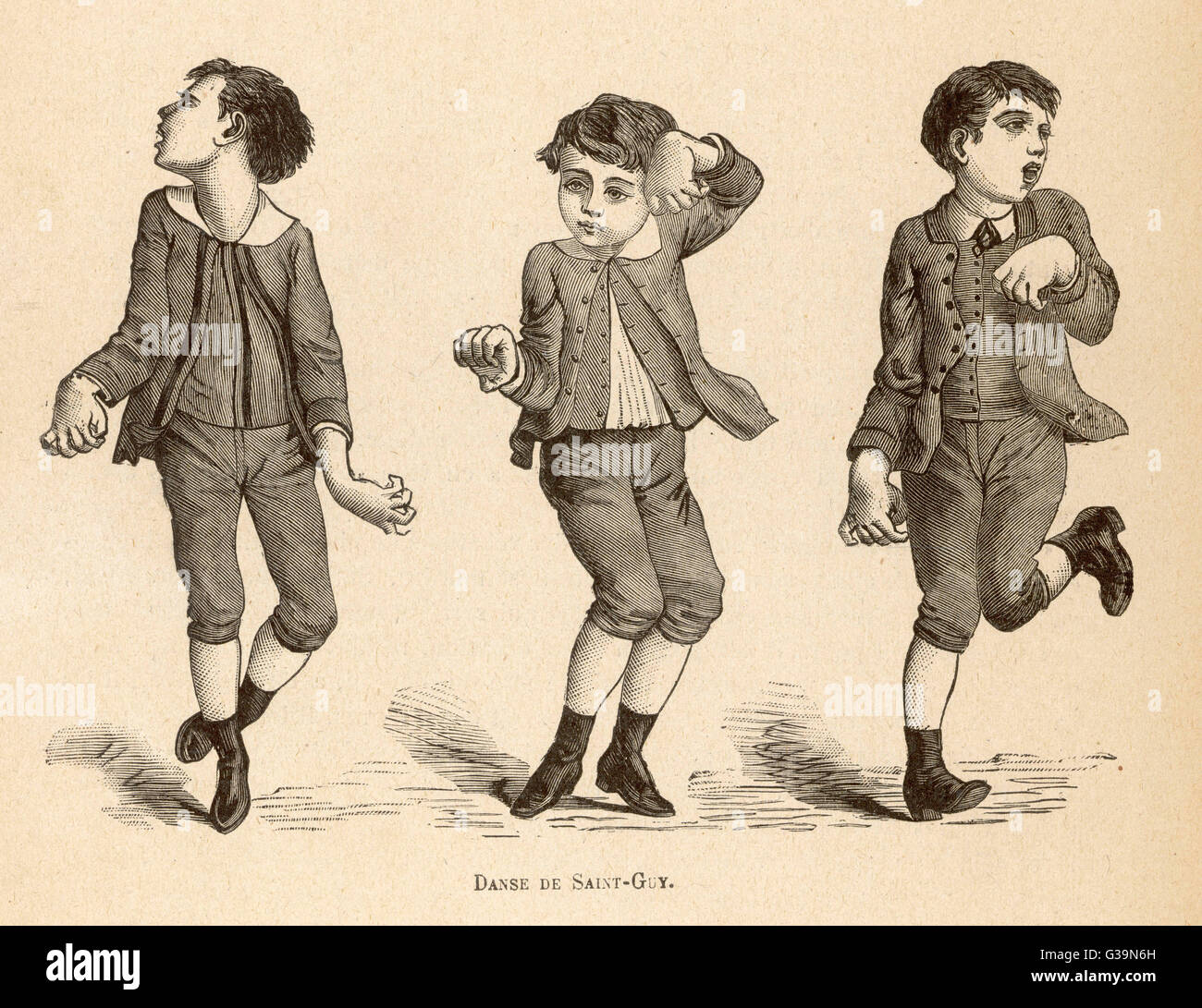 Boys afflicted with Chorea,  known as St Vitus' dance, or  as Danse de Saint-Guy in  France        Date: circa 1880 Stock Photo