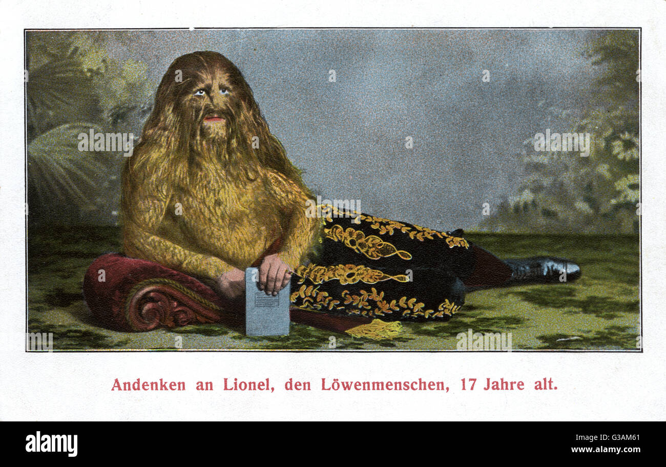 Stephan Bibrowski (18911932), better known as Lionel the Lion-faced Man
