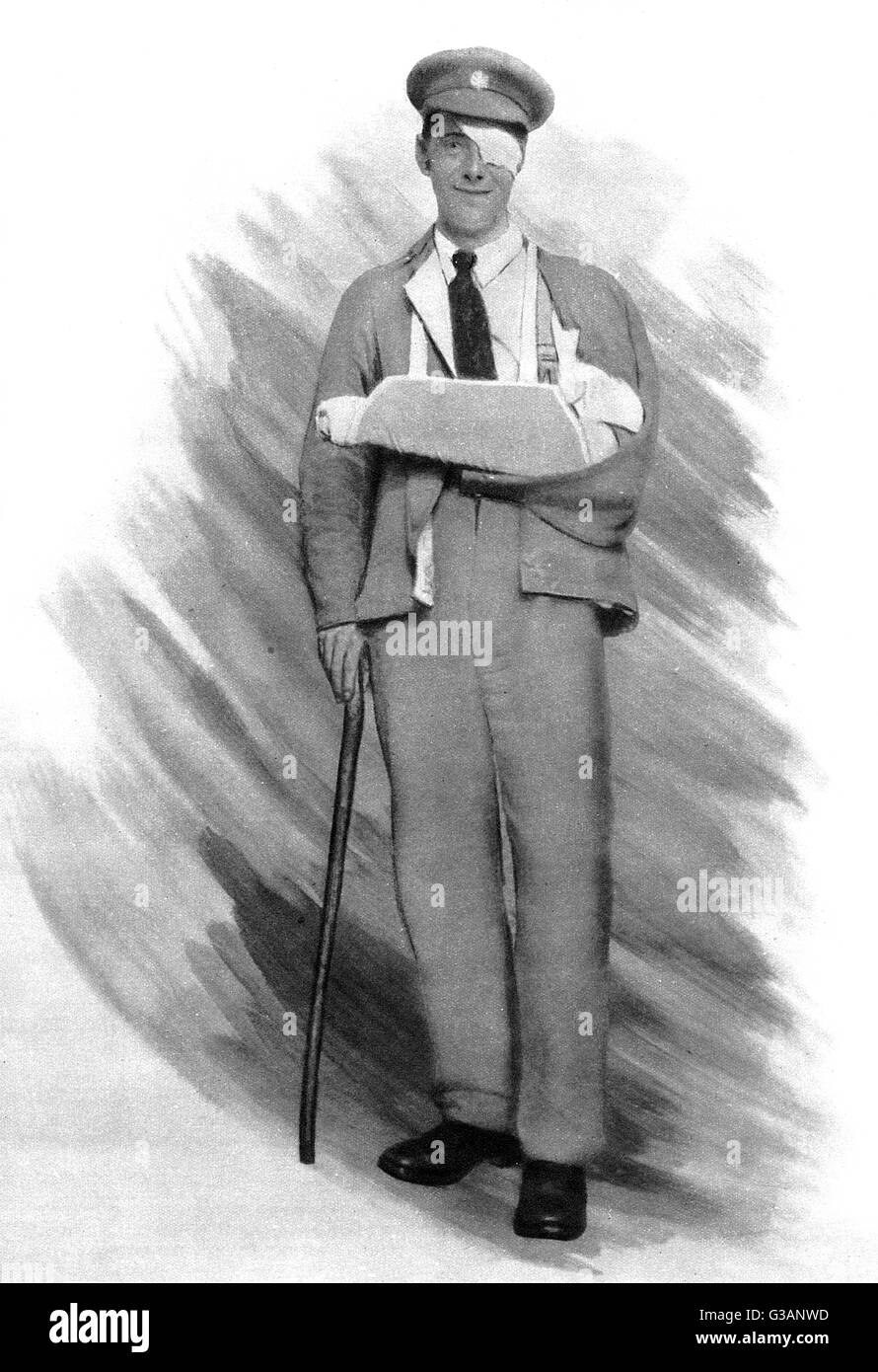 The Wounded Tommy - British Soldier, WW1 Stock Photo