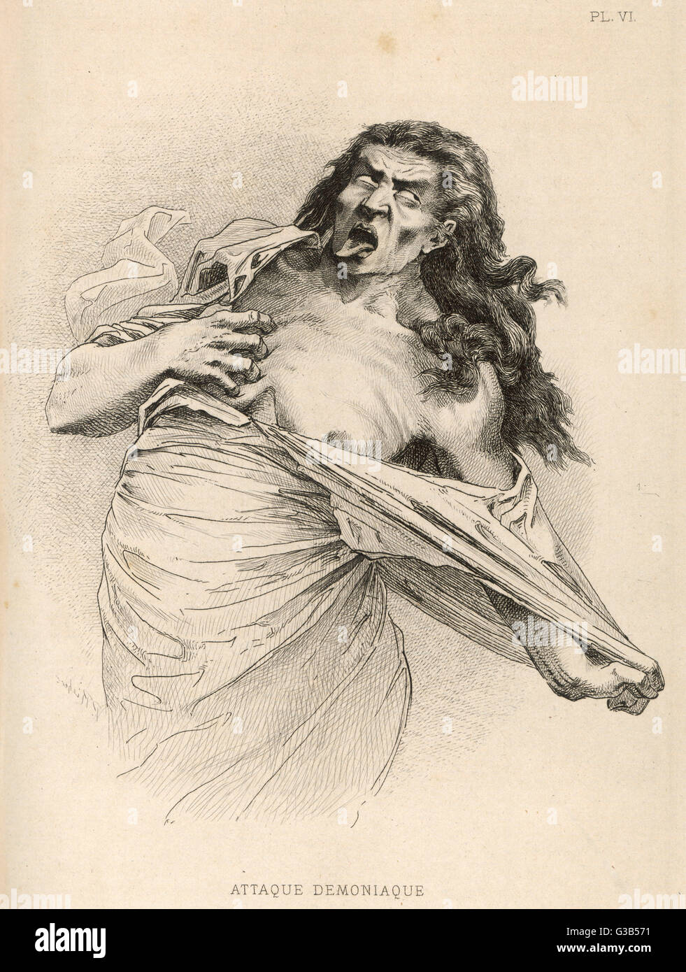 Mental patient at La  Salpetriere in the throes of a  'demoniac attack'        Date: 1881 Stock Photo