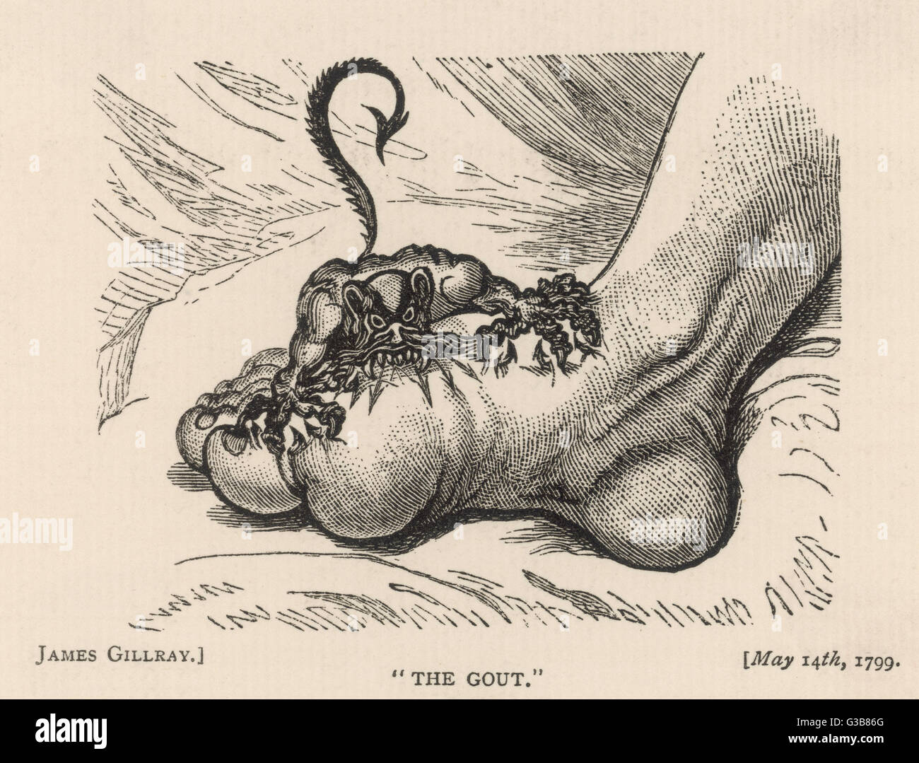 The Gout Devil Bites - 1799 Stock Photo