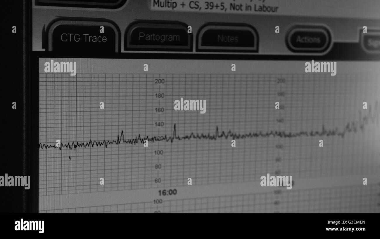 hospital baby labour monitor ctg trace Stock Photo Alamy