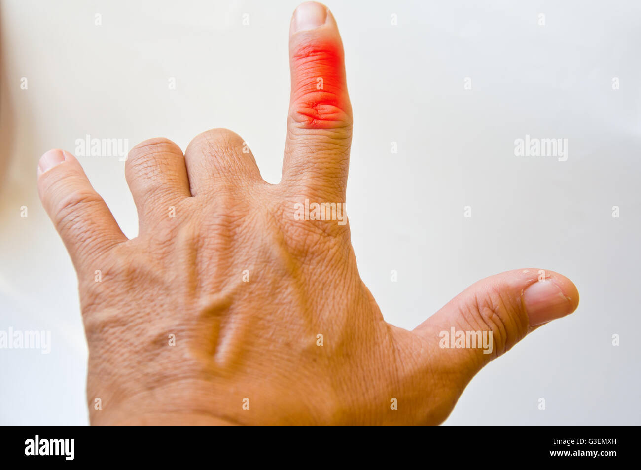 Сильная боль в пальцах рук. Болит указательный палец. Болят пальцы на левой руке. Указательный палец левой руки. Болит сустав большого пальца на руке.