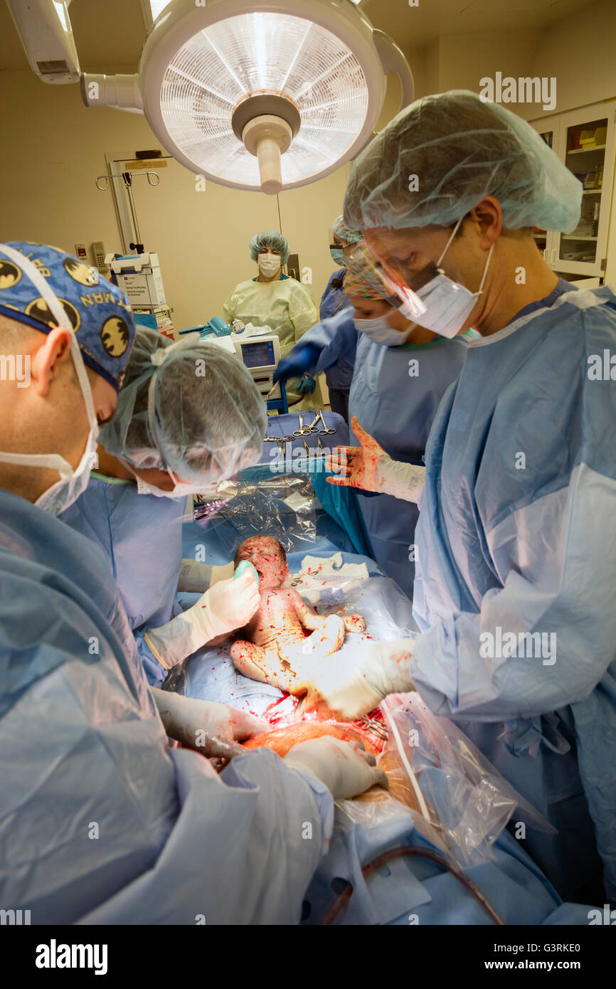 doctors clear airways in new baby born by Caesarian section, Trios Kennewick General Hospital, Tri-Cities, Washington, USA Stock Photo