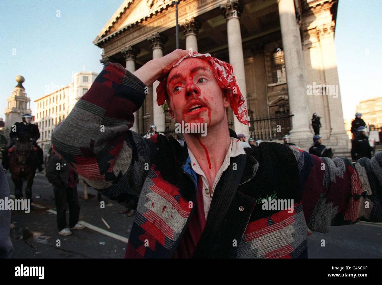 A photographer holds a cloth to his wounded head as trouble breaks out outside St Martin's in the Field, Trafalgar Square, London, this afternoon (Saturday) during the Social Justice March. The march was in support of Liverpool's sacked dock workers. Photo by David Giles/PA. SEE PA STORY INDUSTRY Dockers. Stock Photo