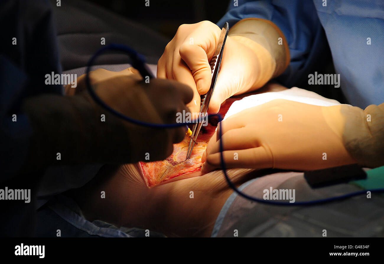 A generic stock photo of an operation taking place at Queen Elizabeth Hospaital, Birmingham. Stock Photo