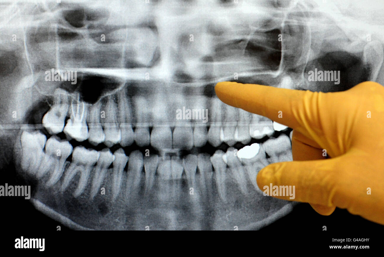 General view of dentist checking an x-ray.. General view of dentist checking an x-ray. Stock Photo