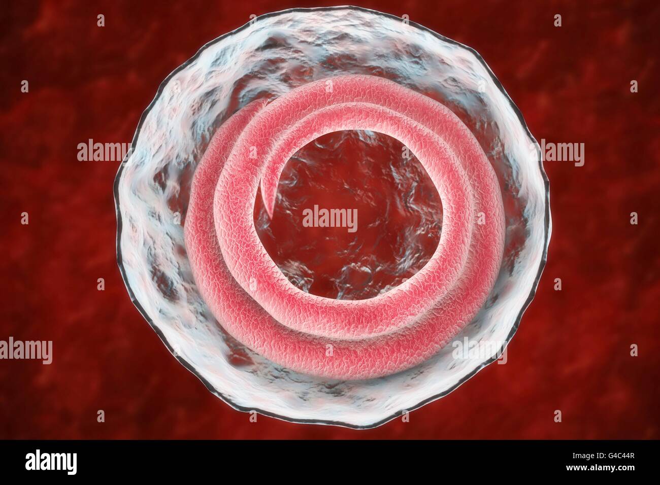 Trichinella spiralis hi-res stock photography and images - Alamy