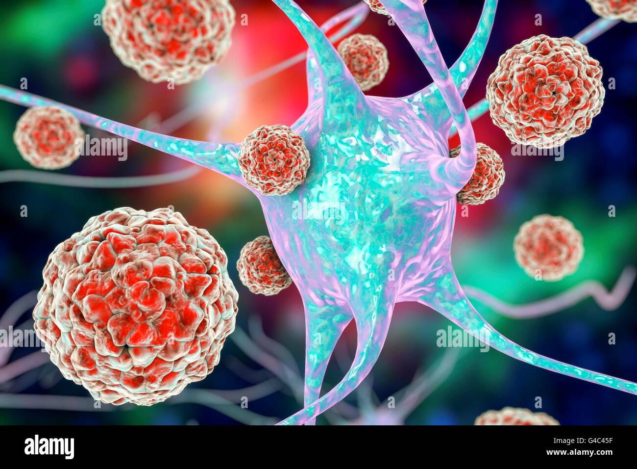 Enteroviruses affecting neuron, computer illustration. Enteroviruses are RNA (ribonucleic acid) viruses from the Picornaviridae family. They cause infections of different locations, including infections of the central nervous system. Stock Photo