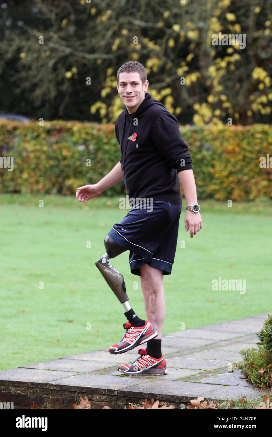 Красивая девушка на искусственных ногах. Оскар писториус протезы. Парень на костылях. Нее нет ноги. Фото ног.