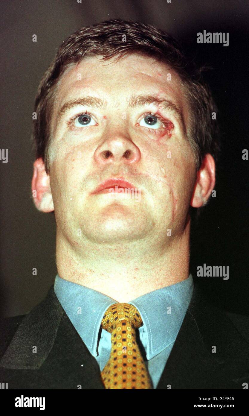 Trevor Rees Jones, who survived the car crash in which Diana The ...