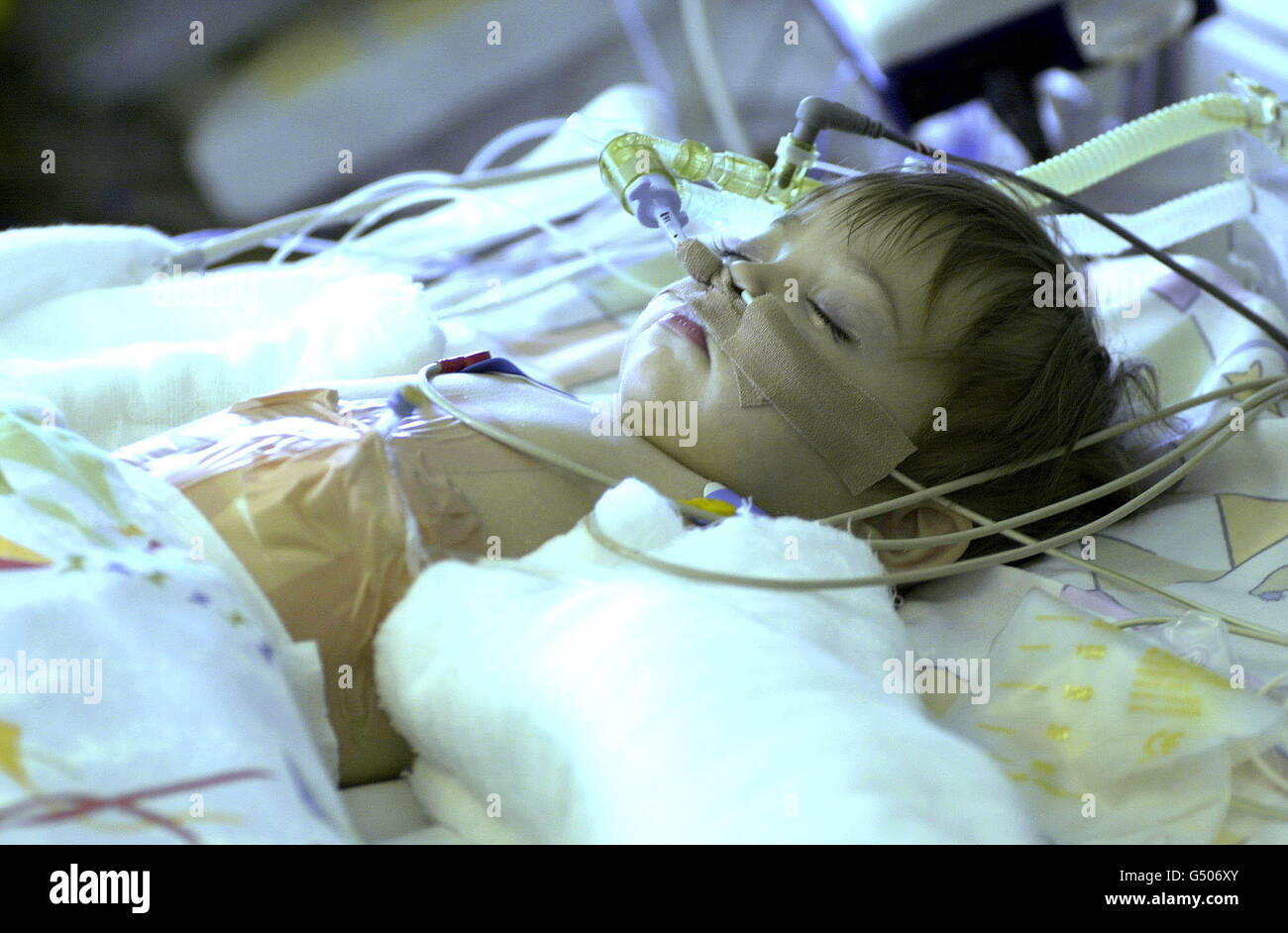 12-month-old baby Tace Corcoran-Rees, at the University of Wales Hospital in Cardiff. The parents, Kirsty Corcoran and Derek Rees, from Cardiff face an agonising wait for a suitable heart donor for their dying daughter. * A national appeal was launched to find a donor for the baby who is critically ill. Stock Photo