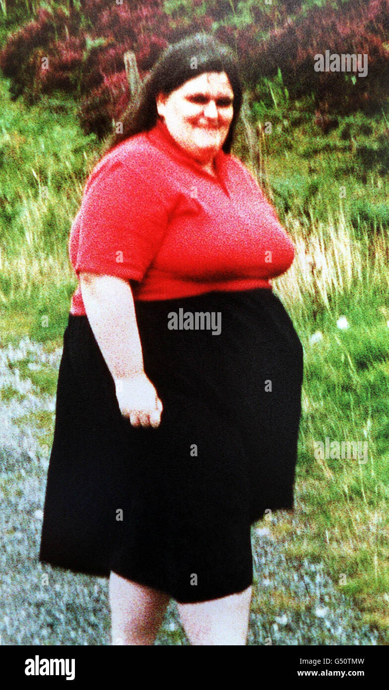 Amanda Saxon before shedding 14 stone and landing her first job. The 32-year-old, of Widnes, Cheshire met Employment Minister Tessa Jowell outside the House of Commons, a year after a 100 New Deal grant allowed her to enrol on a slimming course. * Ms Saxon had been unemployed for 10 years and weighed 28 stone before a Slimming World course financed by the New Deal helped her lose half her body weight. Stock Photo