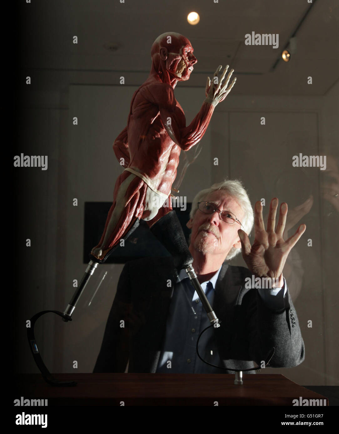 An anatomical wax model of elite athlete richard whitehead hires stock