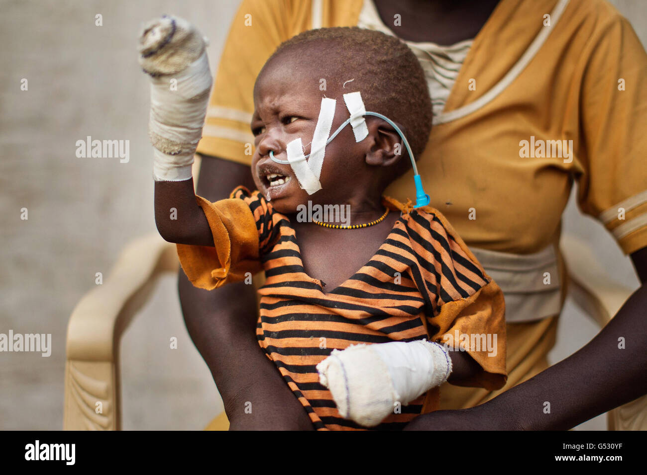A baby injured by the bombing of his village cries in the clinic in Doro refugee camp in Bunj,Maban in the Upper Nile Blue Nile state of northeastern South Sudan, Africa. The region recently suffered from serious clashes between North and South Sudan resulting in tens thousands of people forced into refugee camps like Doro and Jamman and hundreds of deaths from the bombing of villages and clashes between rival armed groups. Stock Photo