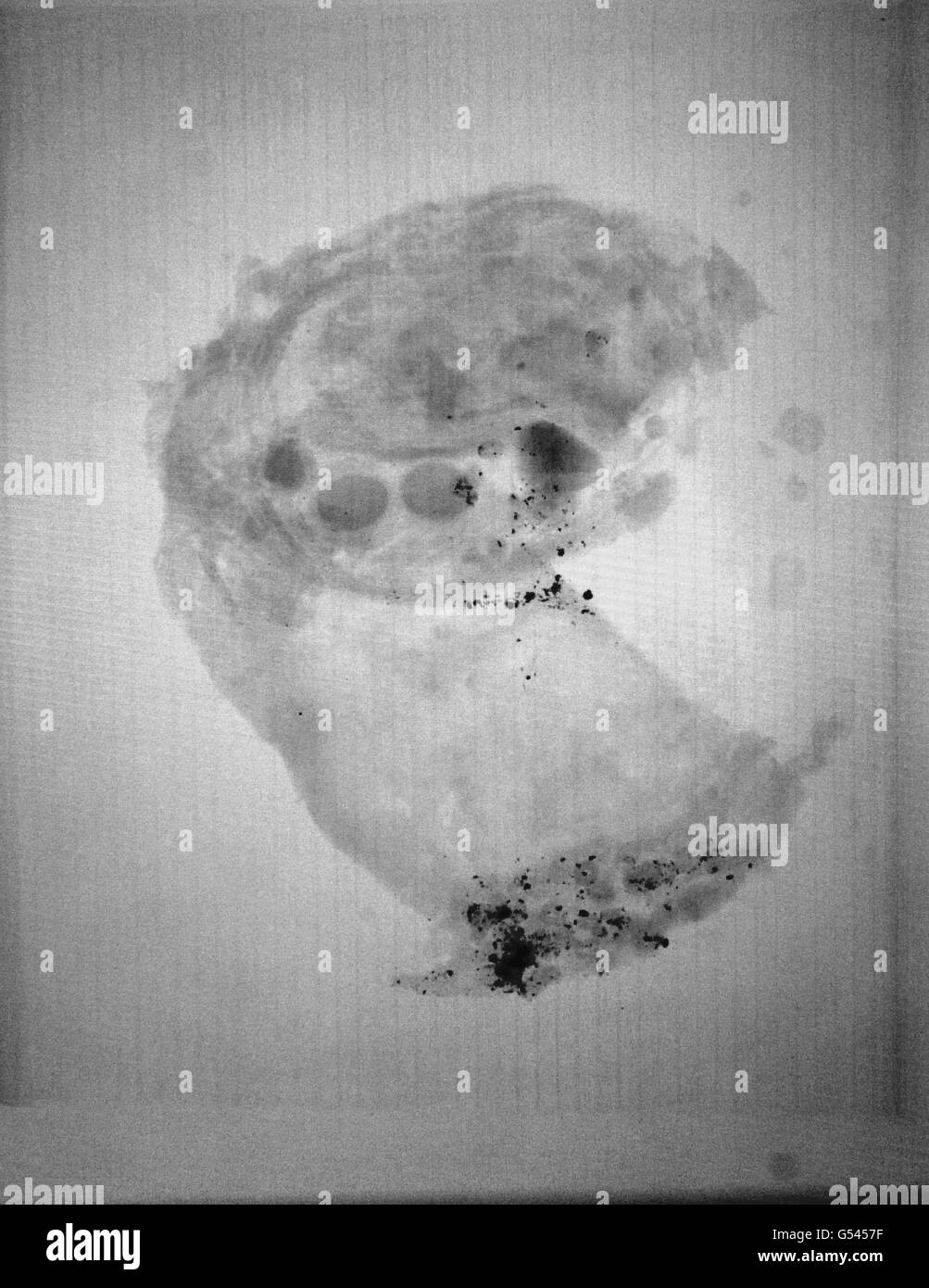 Bronze Age relics xrayed Stock Photo Alamy