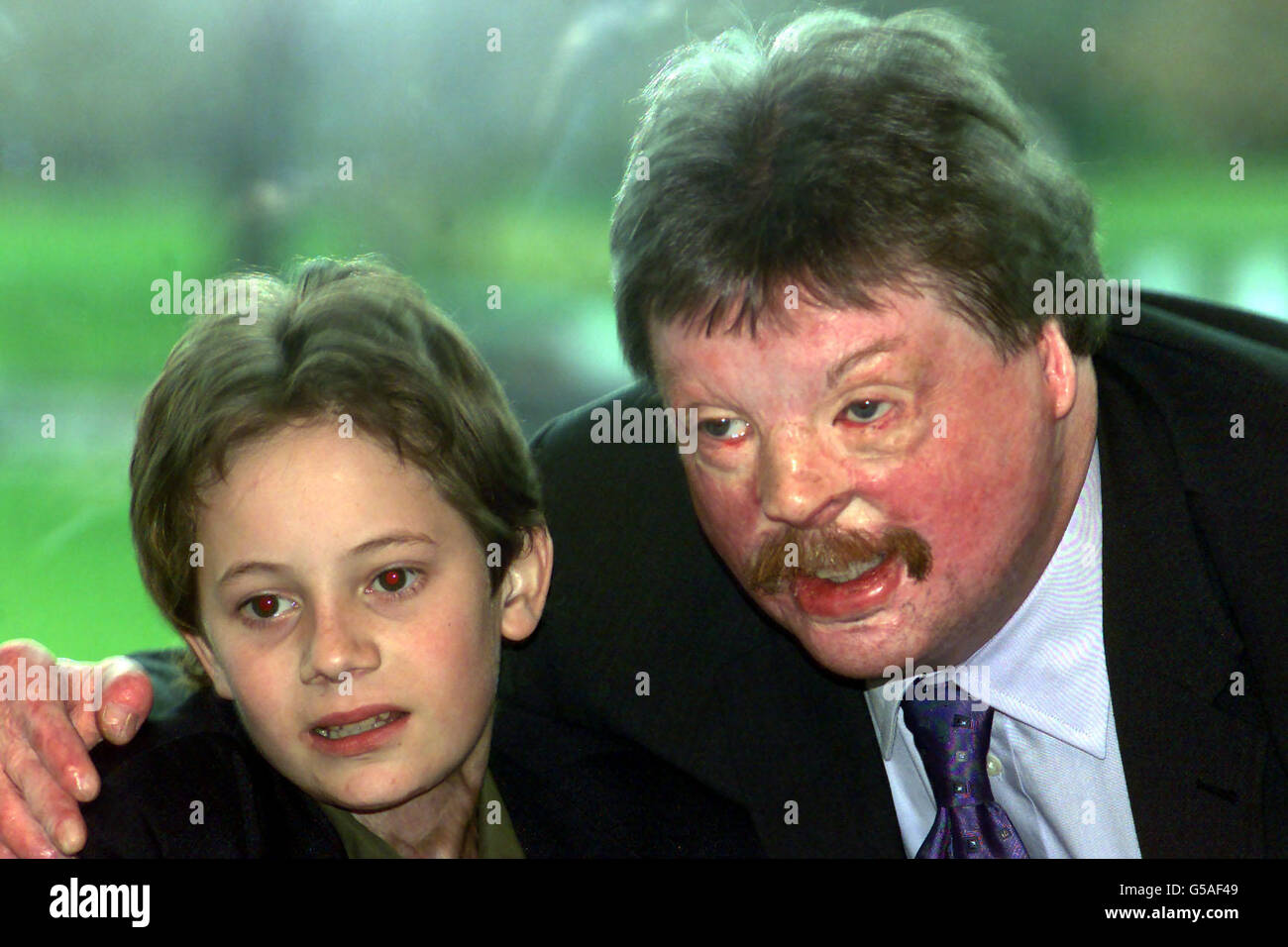 Falklands war veteran Simon Weston in London presenting George Page, 12, from Kent with a Child of Achievement award. In May last year George became a human 'torch' and got burns on 70% of his body. *...Not expected to live, his courage and sheer grit enabled him to return home 3 months earlier than planned. Stock Photo