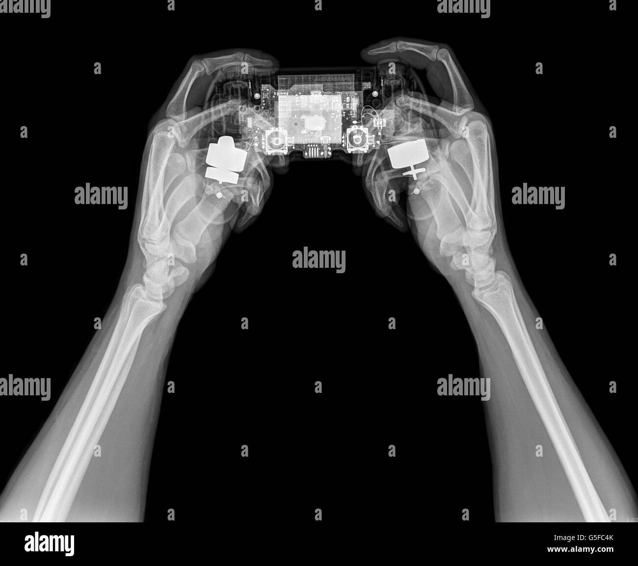 hands holding a Play station (PS4) under x-ray Stock Photo