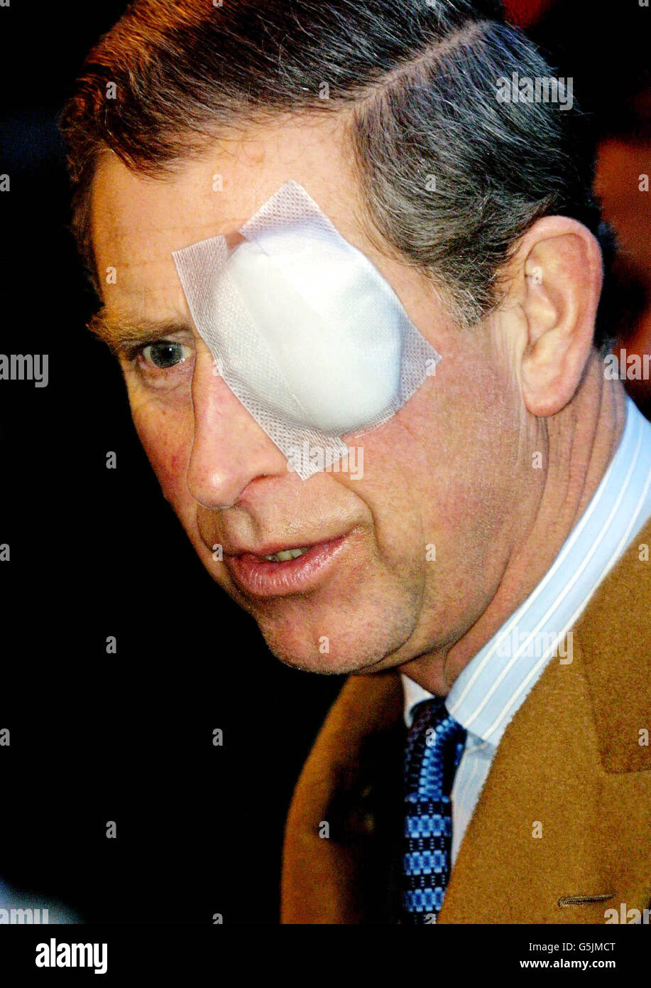 Prince Charles Eye Patch Stock Photo