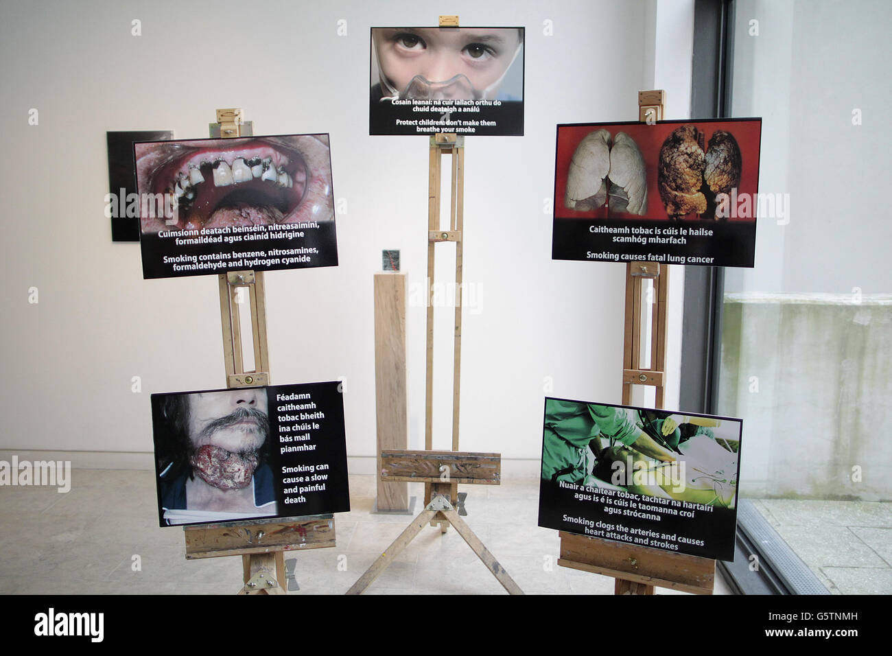 Photographs which will appear on cigarette packaging sold in Ireland at the  RHA Gallery, Dublin Stock Photo