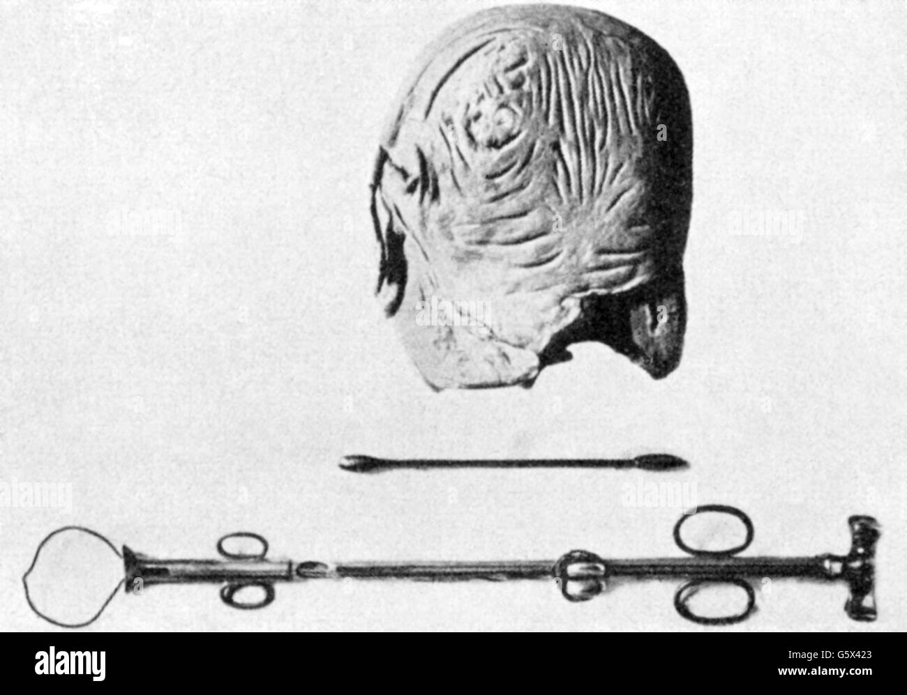 Porro, Edoardo, 17.10.1842 - 18.7.1902, Italian physician / medical doctor, womb amputeed by him during surgery 1876 and medical instruments, museum of the gynaecological clinic, Pavia, Stock Photo