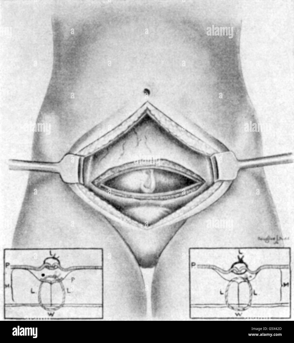 Nova A Walk To Beautiful Anatomy Of Childbirth Pbs