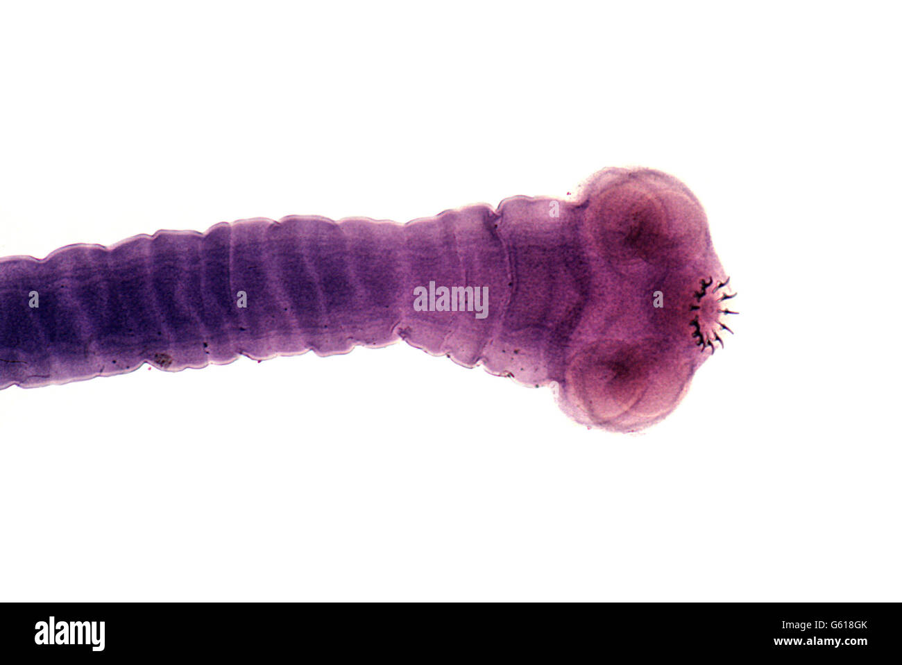 Tapeworm. Scolex (head) of the parasitic pork tape worm, Taenia solium. Stock Photo