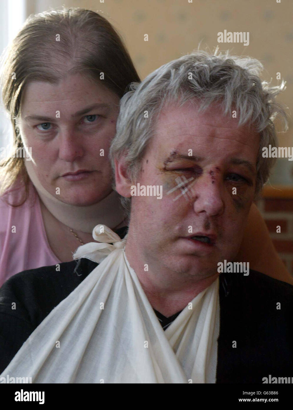 John and Denise Dawes from Middlesbrough who were battered by by teenage thugs wielding bottles, a golf club and a chair leg in an attack as they tried to stop them stealing there car from outside their home. *...The couple had confronted four youths who they believed had tried to steal their car when six more youths appeared and attacked them. Securicor van driver John Dawes was left lying in the street with severe facial injuries, drifting in and out of consciousness. Denise Dawes, 40, who had clumps of her hair ripped out, has told how she faces an anxious wait for the results of hepatitis Stock Photo