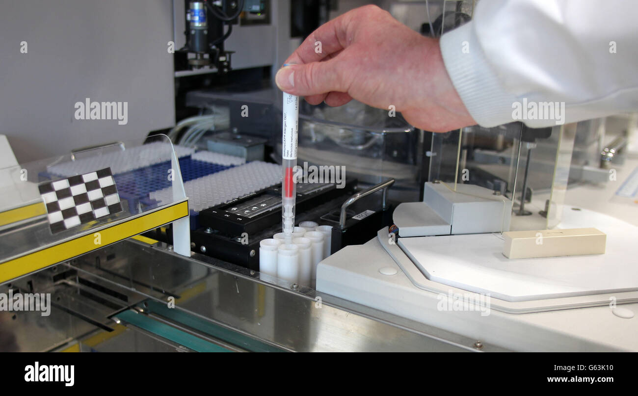 Allergy testing medical equipment opening laboratory medicine centre hi