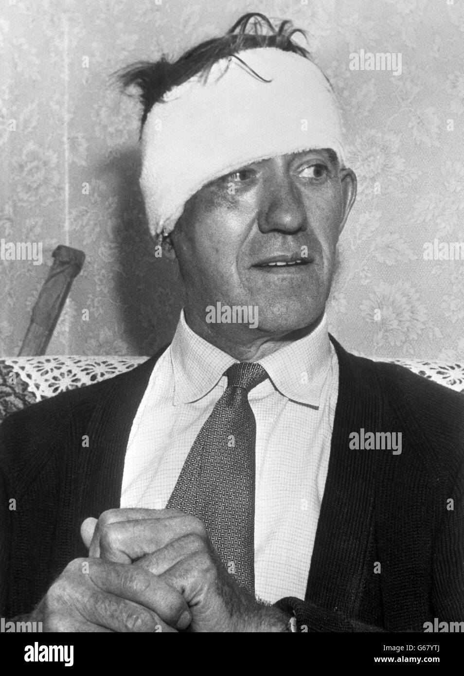 Jack Mills, 57, driver of the mail train hi-jacked by the Great Train Robbers, at his home in Newdigate, Crewe, after telling the Press the train robbery was like a military operation. Mills, whose head was heavily bandaged after been injured in the robbery, spent three days in hospital before returning home. Stock Photo