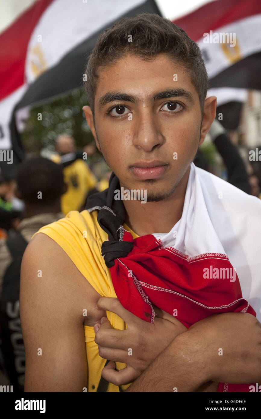 Mahmoud Ahmed shows his injuries he sustained while in Egypt protesting last month, during a protest with The Egyptian Irish Anti-Coup Forum on O'Connell Street, Dublin. Stock Photo