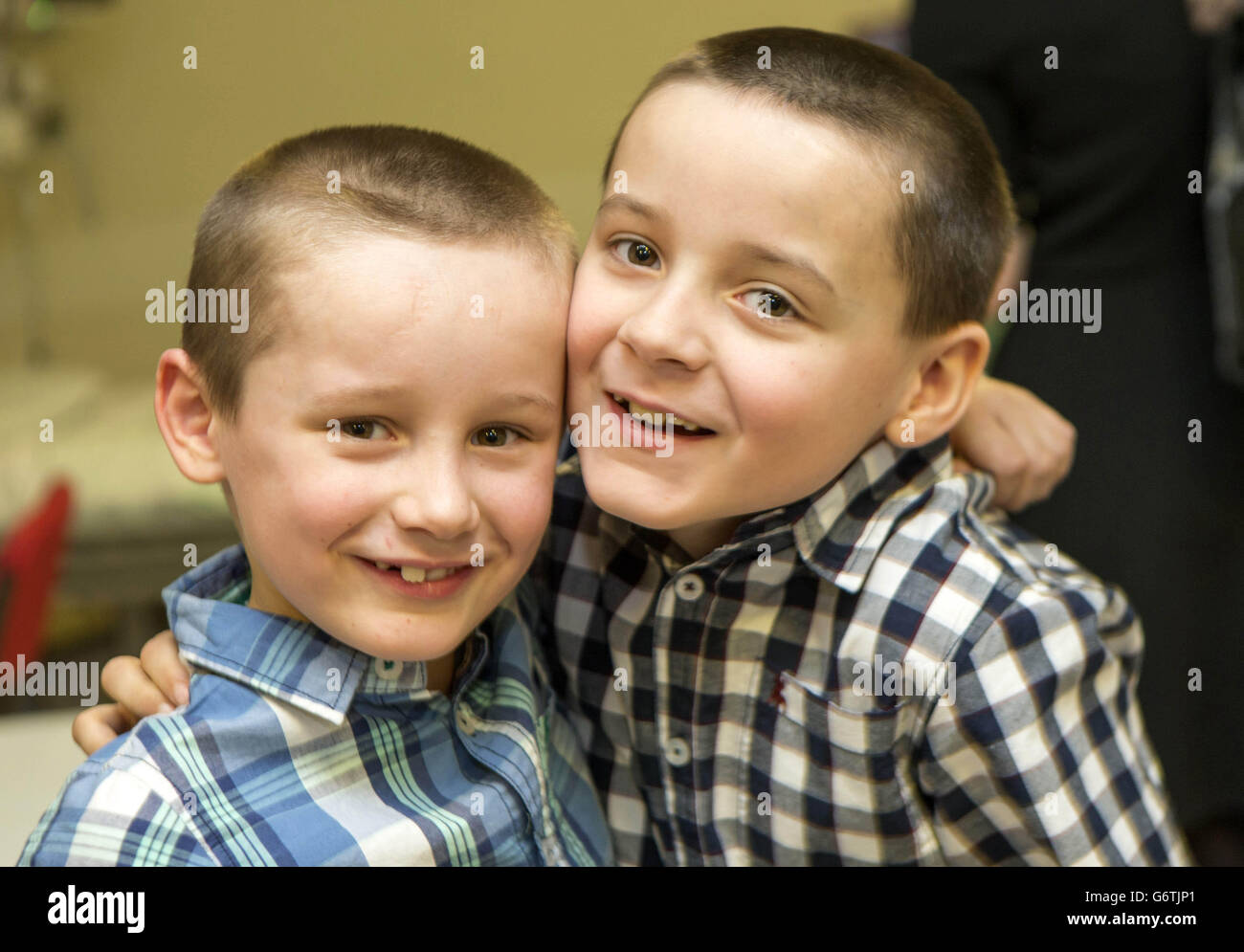 Brothers, Kyle Roper, aged 7, (left) and Ethan Roper, aged 8, (right) prepare to have the Medtronic Reveal LINQ Insertable Cardiac Monitor implanted into their upper chest by Dr Mike Blackburn, Paediatric Consultant Cardiologist, at Leeds General Infirmary in Leeds. Stock Photo