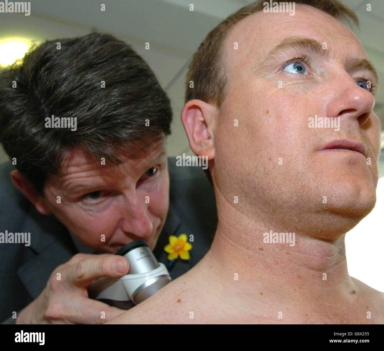 Hampshire cricketer Shaun Udal (right) is looked over by Consultant Dermatologist Doctor Steve Keohane, who is director of Portsmouth Dermatologist Centre, as part of the NatWest/Marie Curie Cancer Care 'Sun Safety - Don't get caught out' campaign - at Hampshire C.C. Rose Bowl Ground Southampton. Stock Photo