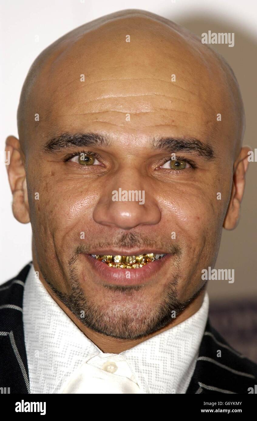 Aka Rapper Gold Teeth