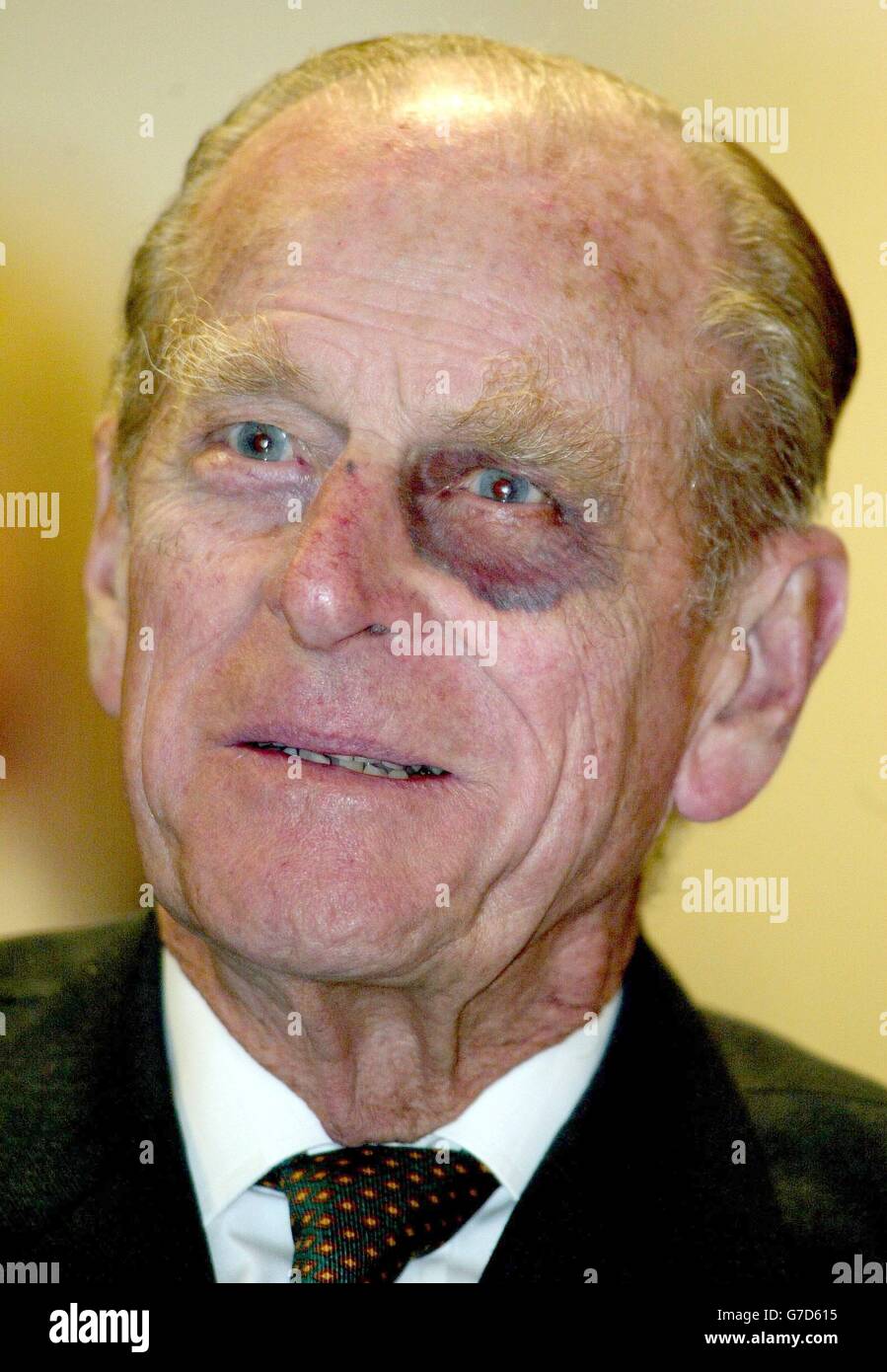 Sporting a black-eye, the Duke of Edinburgh tours the new Baglan Power Station in Port Talbot, South Wales. The American GE plant is reputed to be the most efficient gas turbine system in the world. Stock Photo