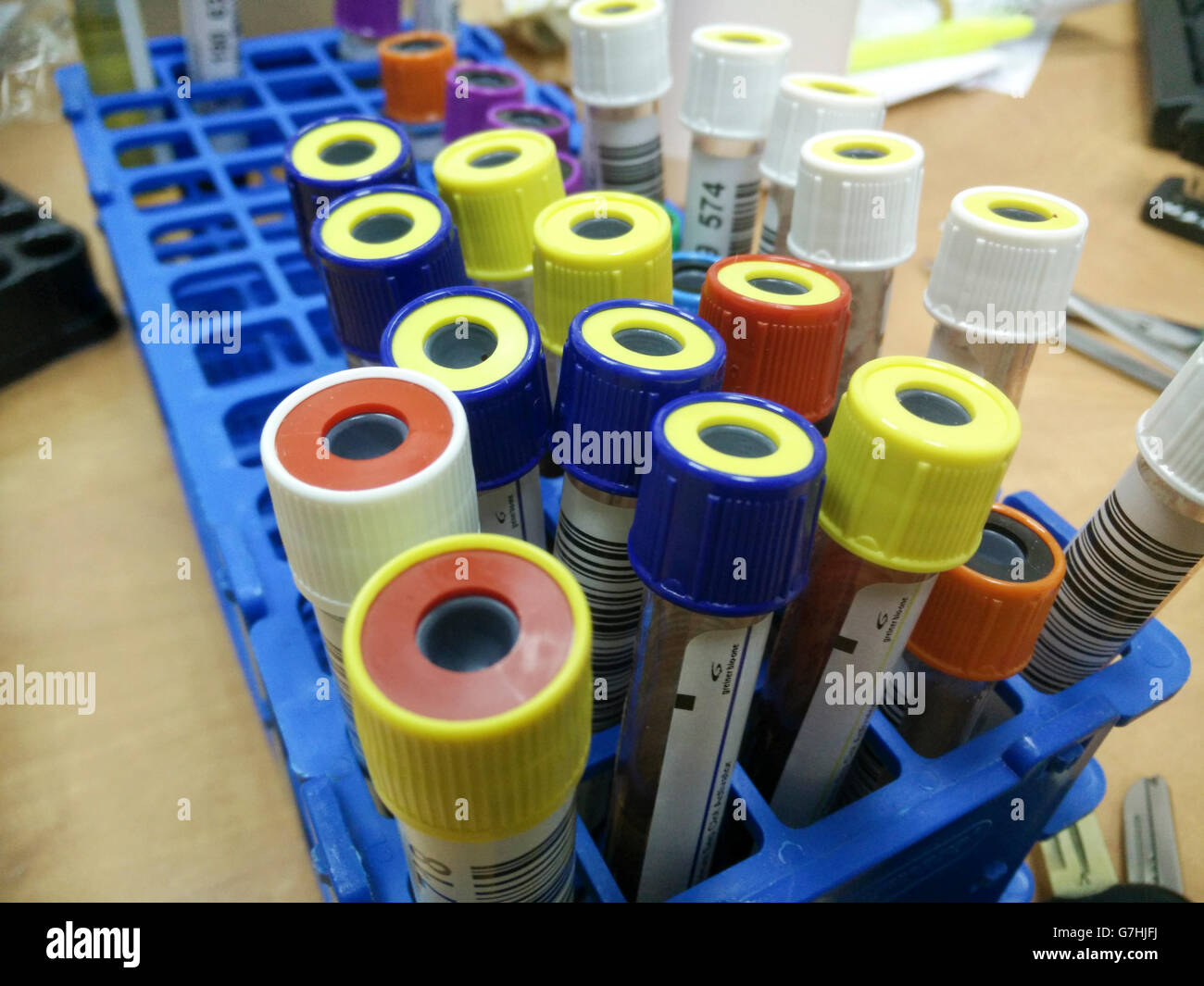 Young girl of six having blood drawn from her arm for a blood test Stock Photo Alamy