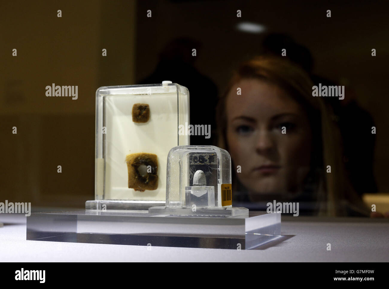 A piece showing a suicidal gunshot wound and bullet on display at The