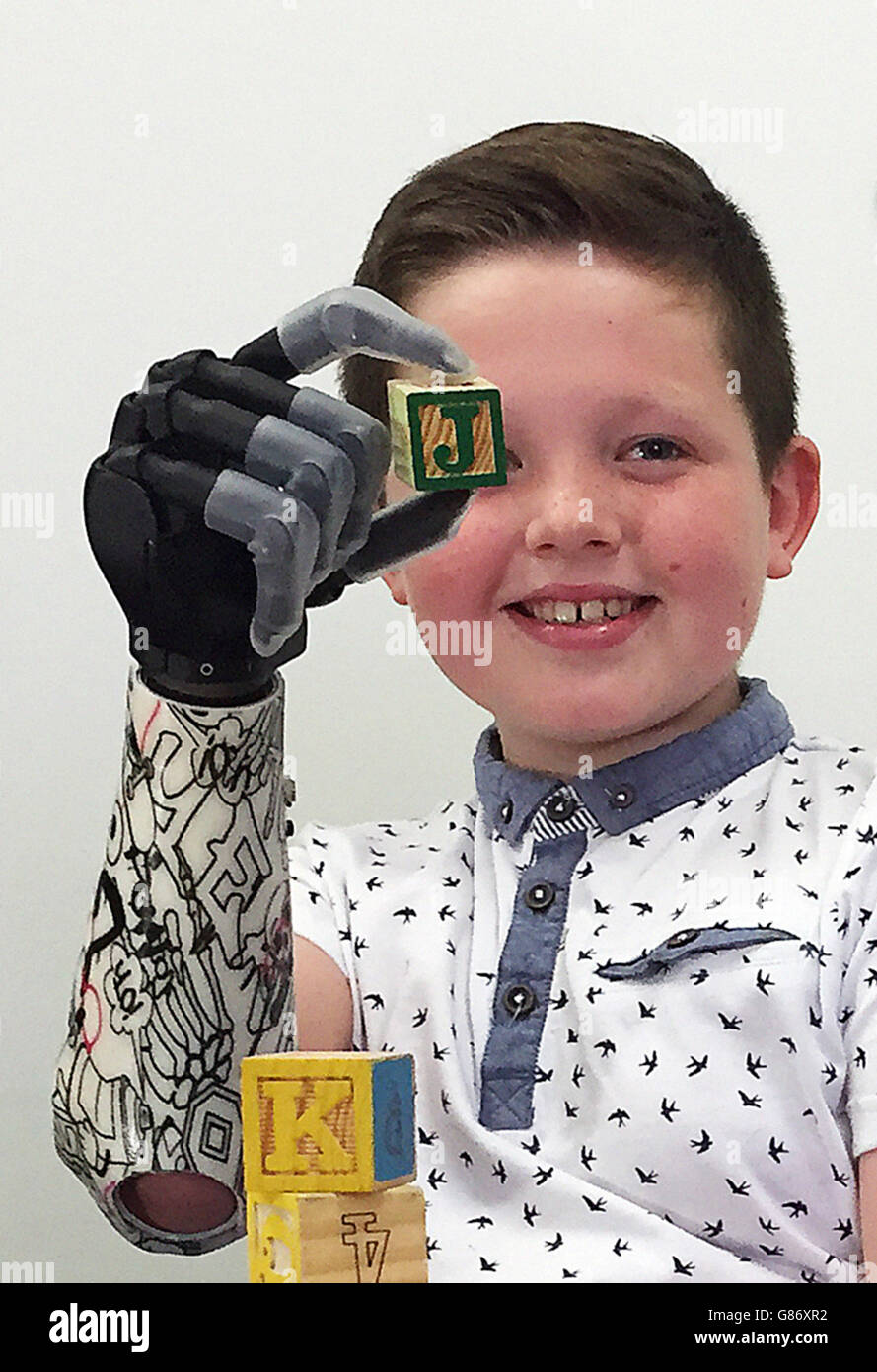 Josh Cathcart, nine, of Dalgety Bay, Fife, who has become the first boy in the UK to be fitted with a child-sized bionic hand. Stock Photo