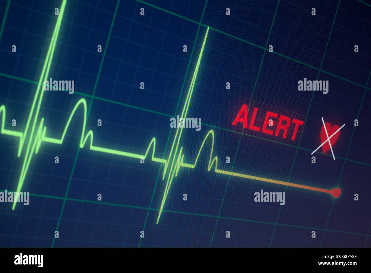 Heart beats cardiogram on the monitor Stock Photo