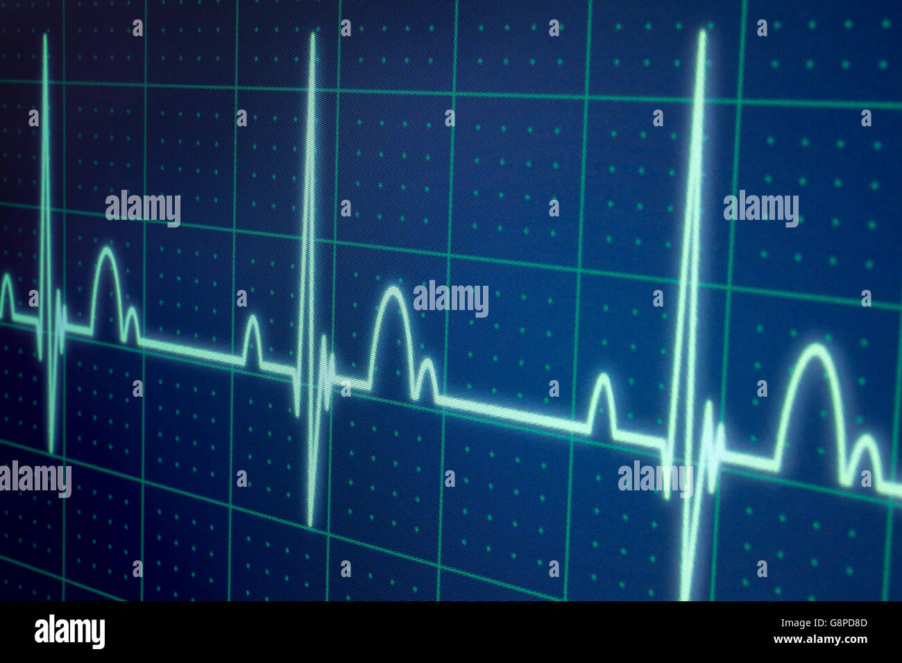 Flatline blip on a medical heart monitor ECG / EKG (electrocardiogram) with blue background Stock Photo