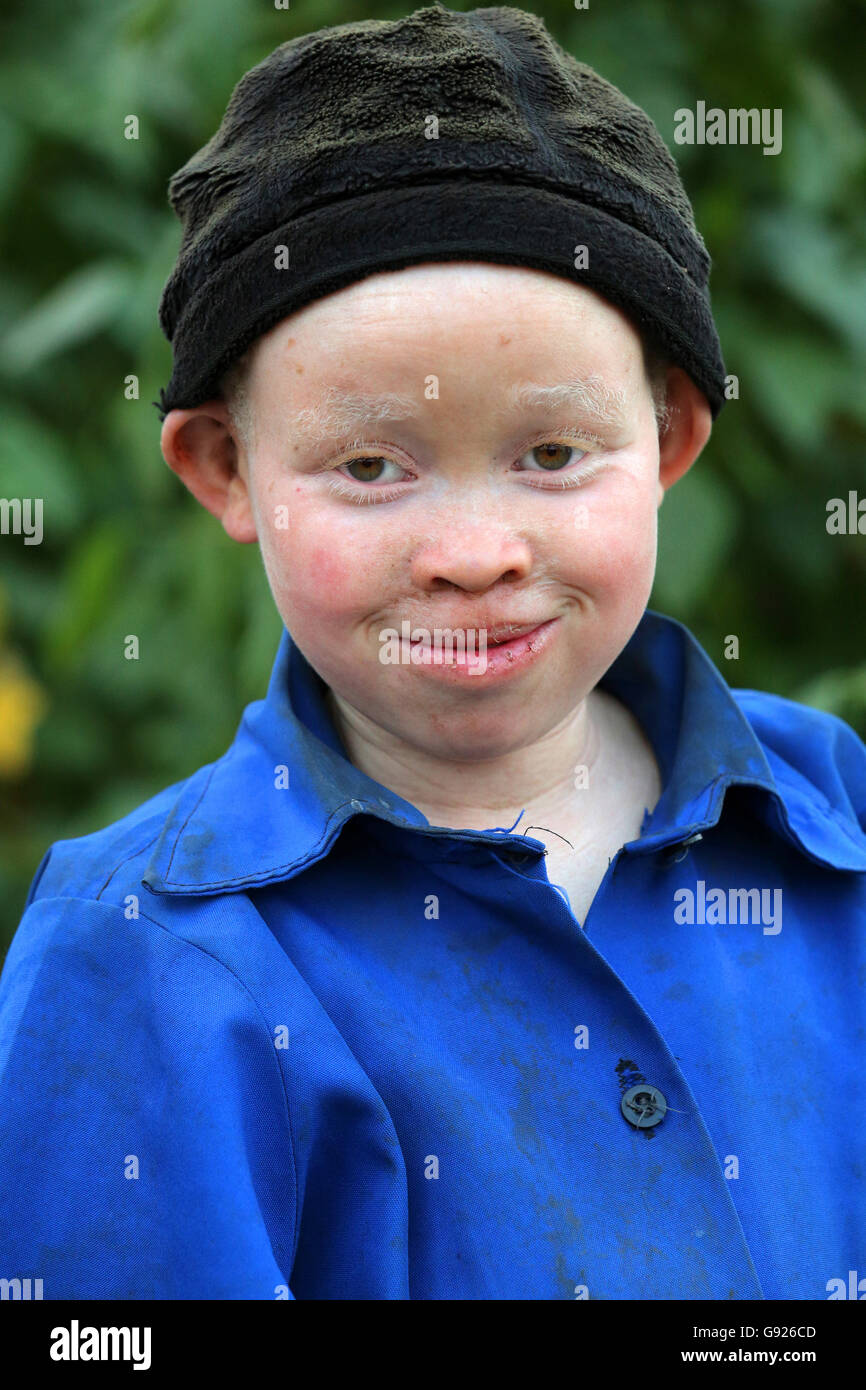 Albino girl hi-res stock photography and images - Alamy