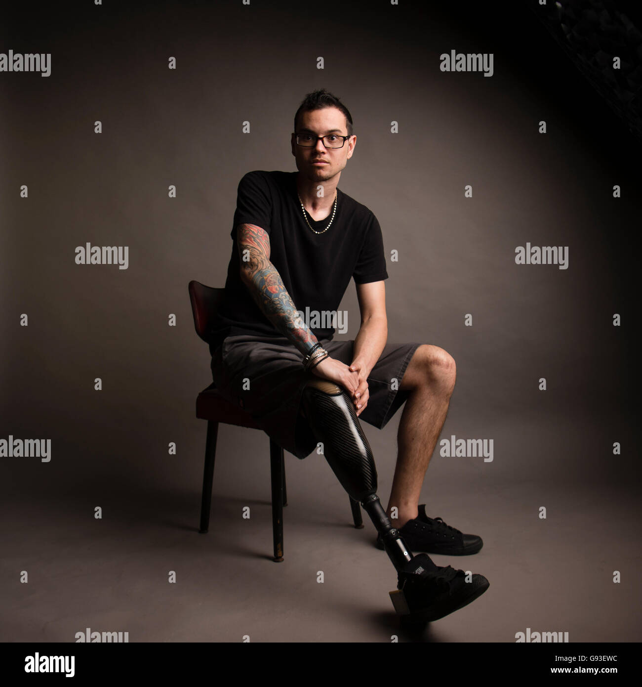 Jay, who has had his right leg amputated below the knee after a car