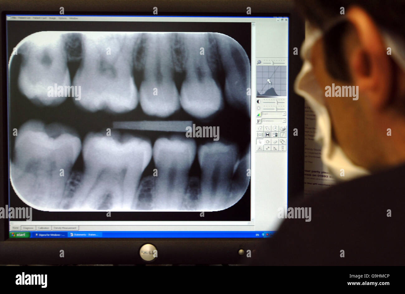 A Dentist examines XRay results Stock Photo Alamy
