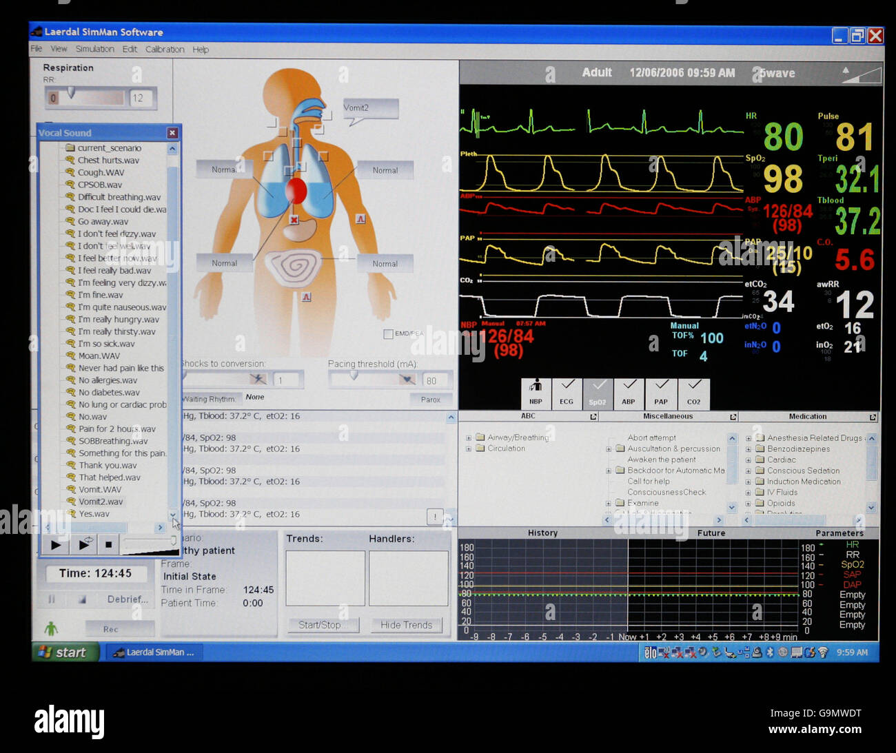 A close-up image of the lap-top screeen used by lecturers to observe ...