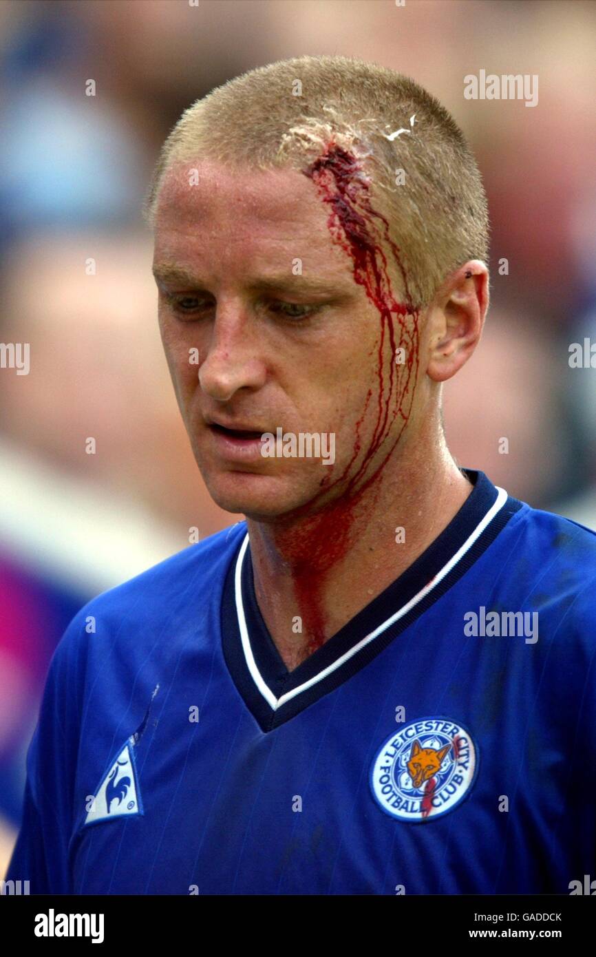 Leicester City's Matt Elliott bleeds profusely from his head after  receiving an elbow from Athletic Bilbao's Aduriz Stock Photo - Alamy